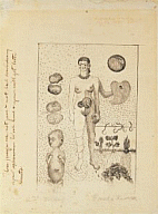 Frida Kahlo, Frida y el aborto, 1932