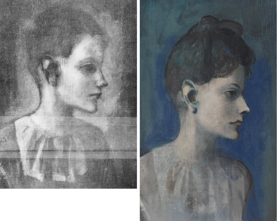 Detail of X-radiograph showing the boy’s head and detail of the same area showing the girl’s head