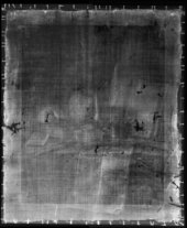 Fig.2 X-radiograph of Still Life 1699