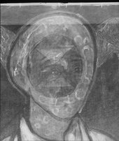 Detail of X-radiograph showing the face